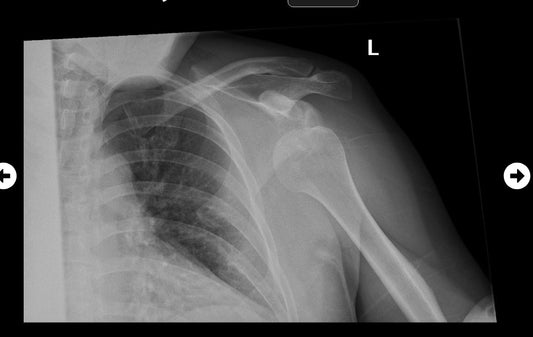 THE HERO'S JOURNEY IS THE CRAWL: THE ATHLETE’S GUIDE TO RESILIENCE